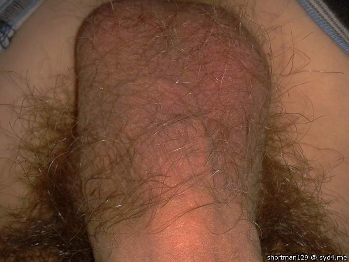 Photo of a penile from shortman129