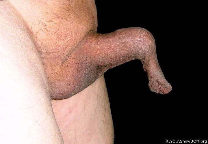 Wow!!! What a long foreskin!!!!   
