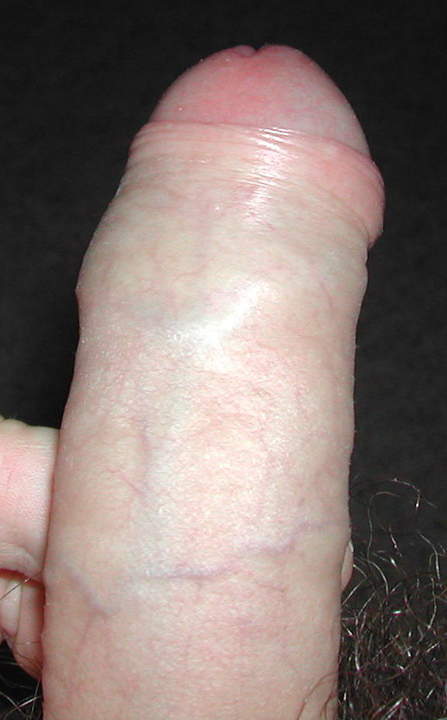 Photo of a penis from robertforladiesl