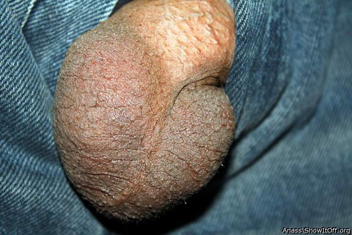 Testicles Photo from Anass