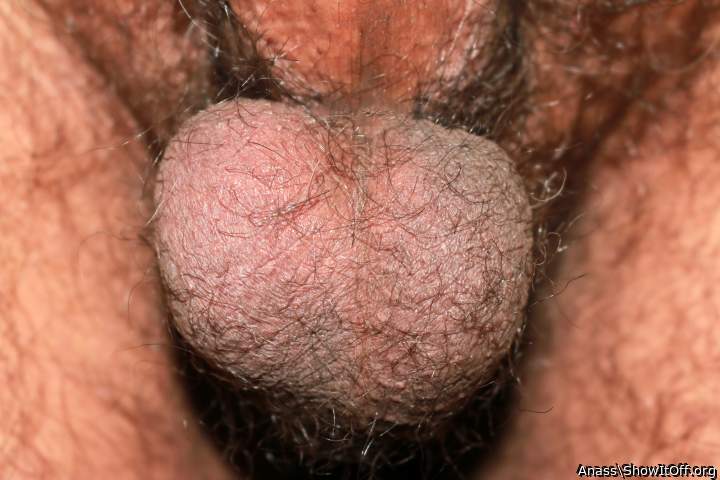 Testicles Photo from Anass