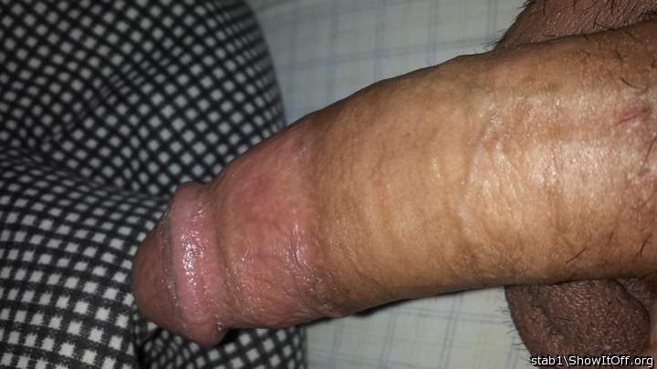 Photo of a love muscle from stab1