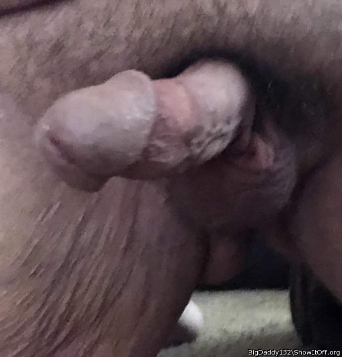 Photo of a short leg from BigDaddy132
