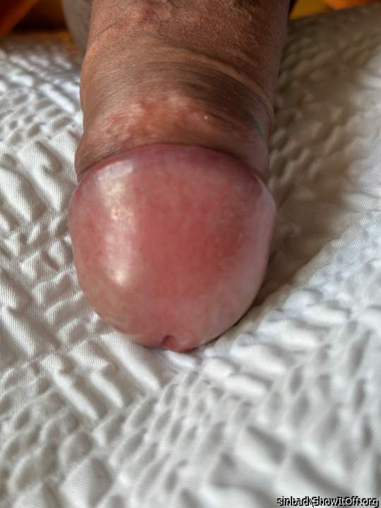 Awesome glans and cock shaft.      