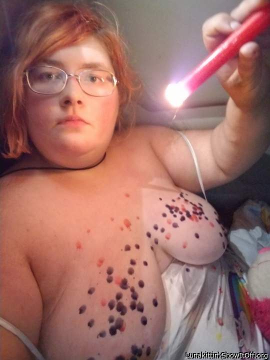  hopefully this won't cause any scars...