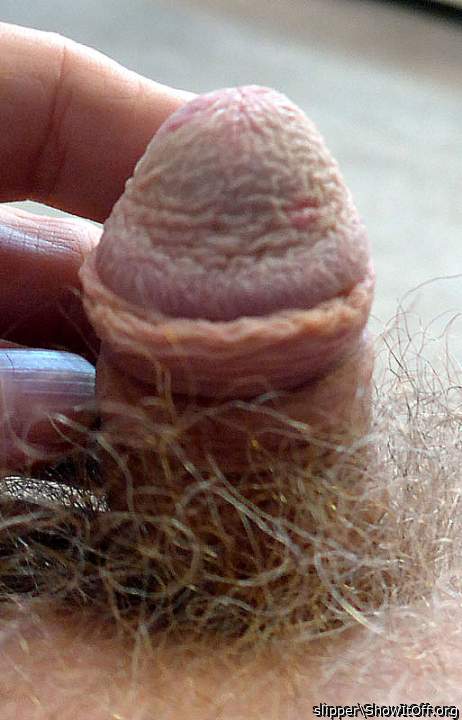 Today, glans uncovered 9-months