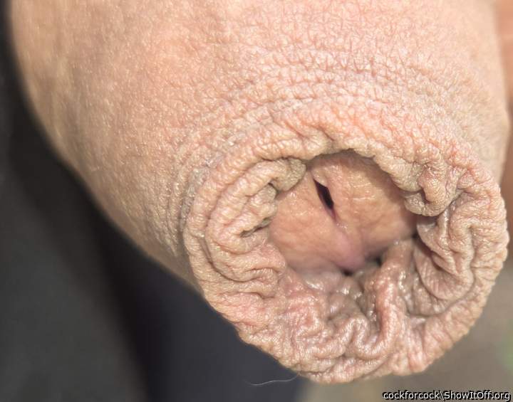 Today his skin was very prominent