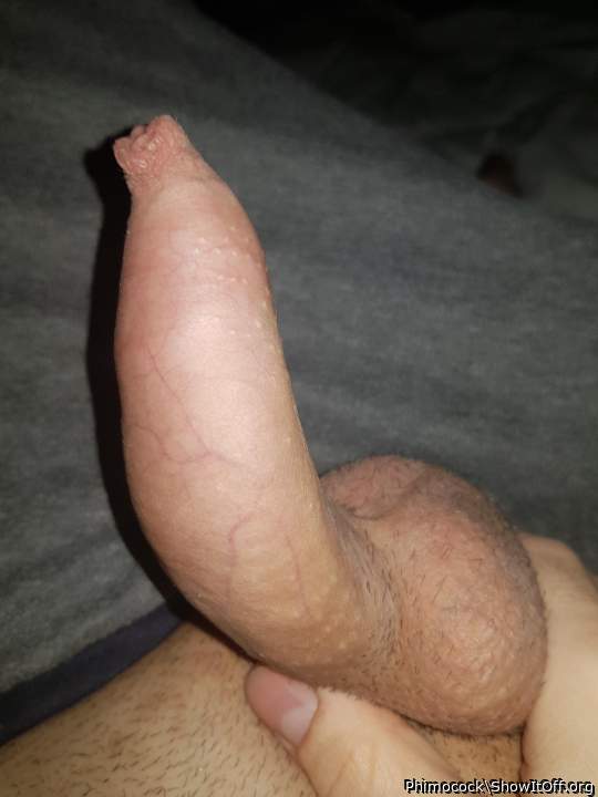 Oh Wow! that's a long foreskin overhang