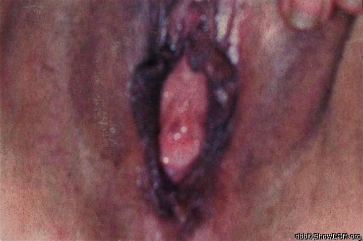 Photo of slit from ribbit