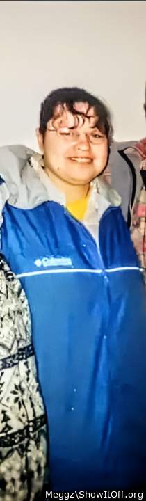 me at 18 dimples! 🤭