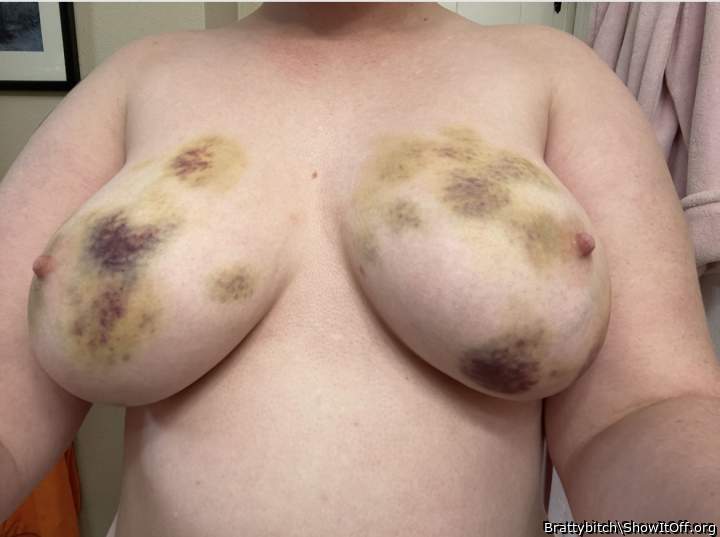 Beautiful you have some amazing breast