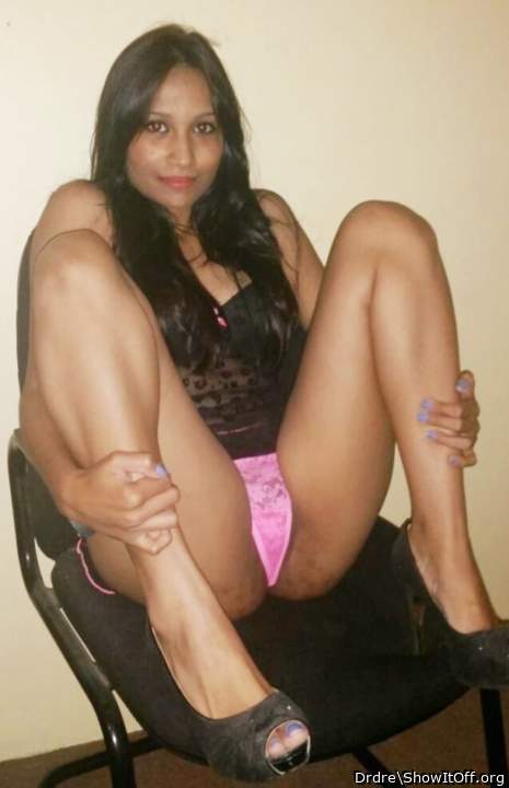 Photo of labia from Drdre