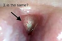 Endoscopy in my cumhole!