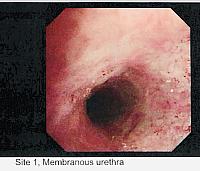 Endoscopy Internal Cock Pic 2