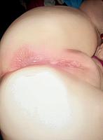 photo of flaps