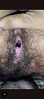 photo of lower lips