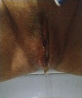 photo of vagina