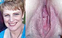 photo of vulva
