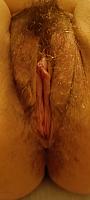 photo of labia