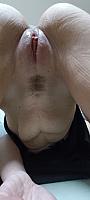 photo of vulva