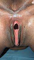 photo of lower lips