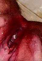 photo of gash