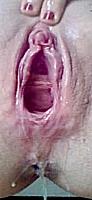 photo of clam