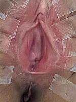 photo of crotch