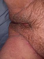 photo of hole