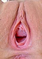 photo of crotch